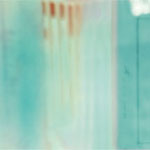Anamnesis